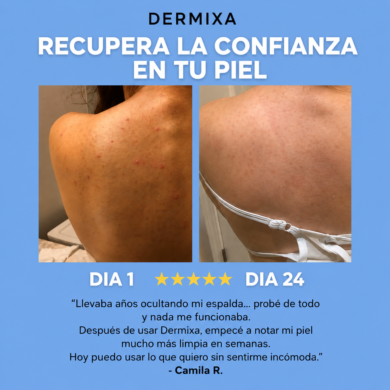 Dermixa™ Acne Bar